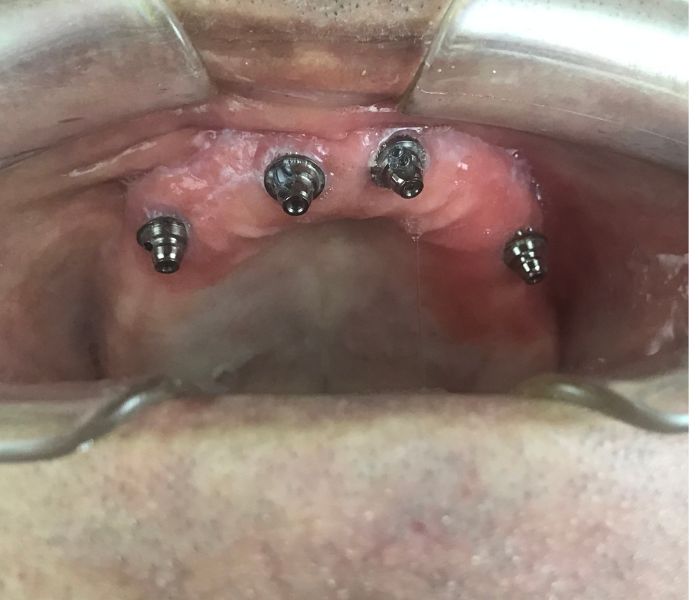B (3)